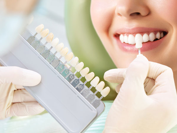 カウンセリング・口腔内診査